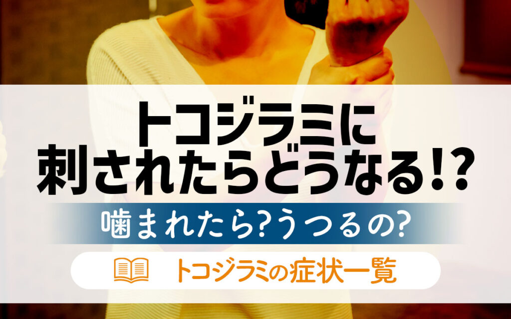 トコジラミに刺されたらどうなる！？噛まれたら？うつるの？【症状一覧】