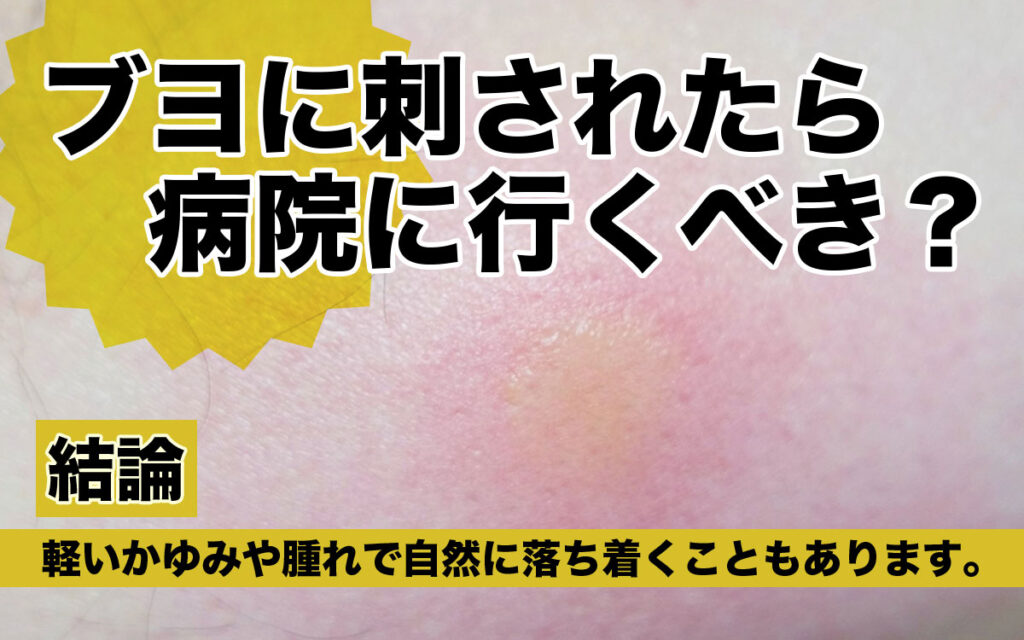 ブヨに刺されたら病院へ行くべきなの?