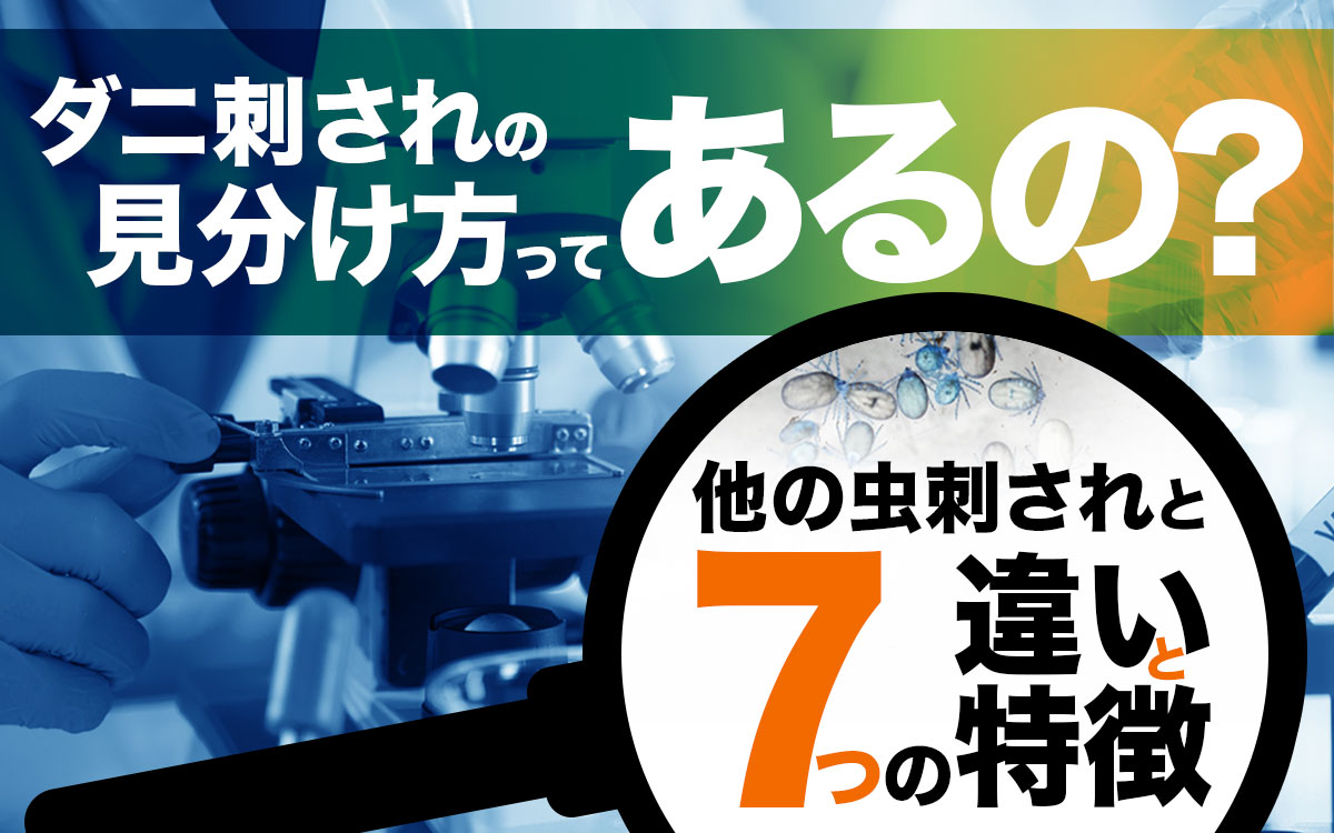 『ダニ刺されの見分け方』他の虫刺されと7つの違いと特徴をまとめました。