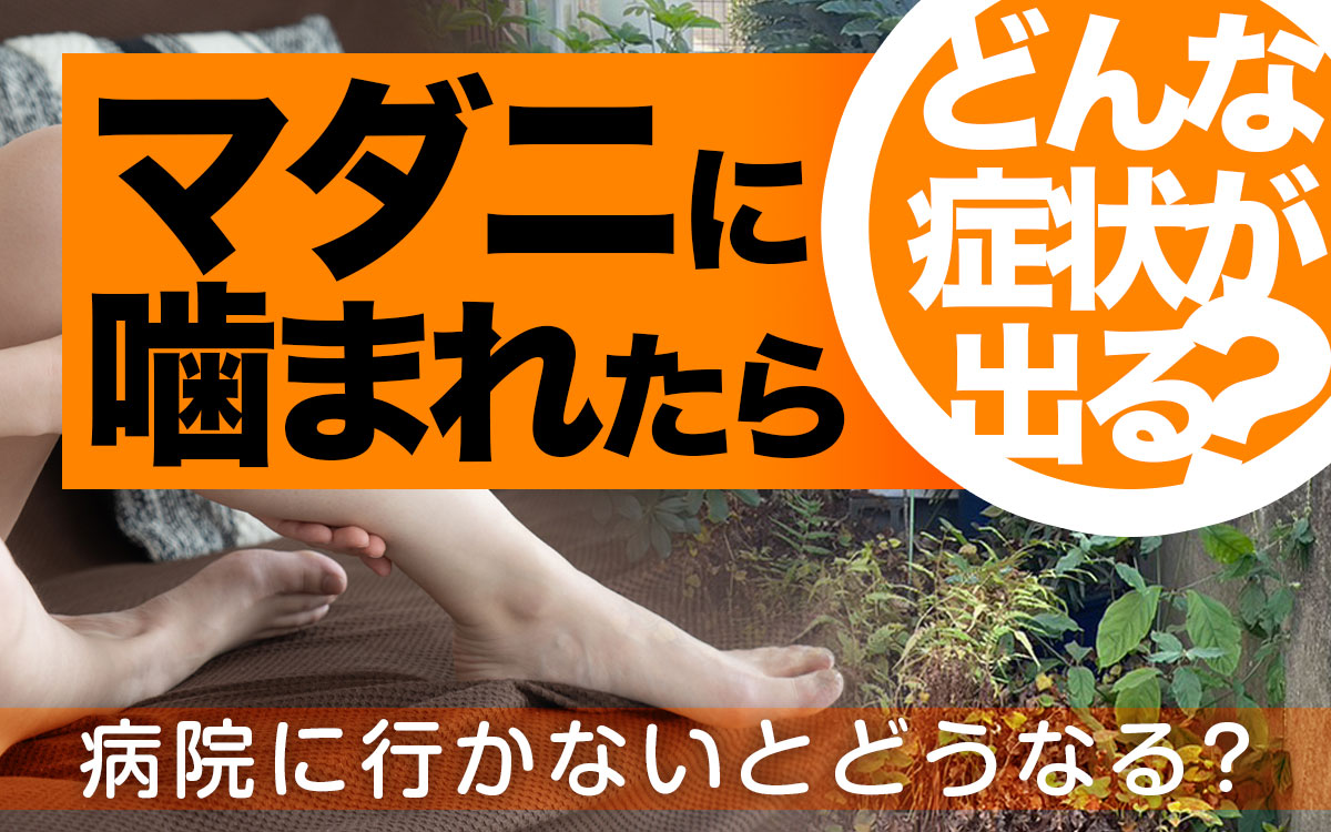 マダニに噛まれたらどんな症状が出るの?病院に行かないとどうなるの?