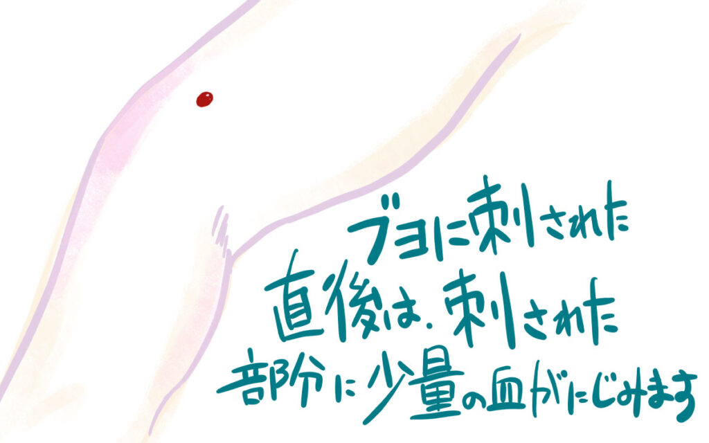 ブヨに刺されるとどんな症状が出るのでしょうか?