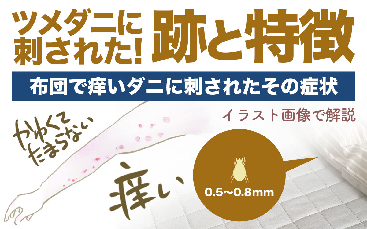 ツメダニに刺された跡と特徴､症状をイラスト画像で紹介しました