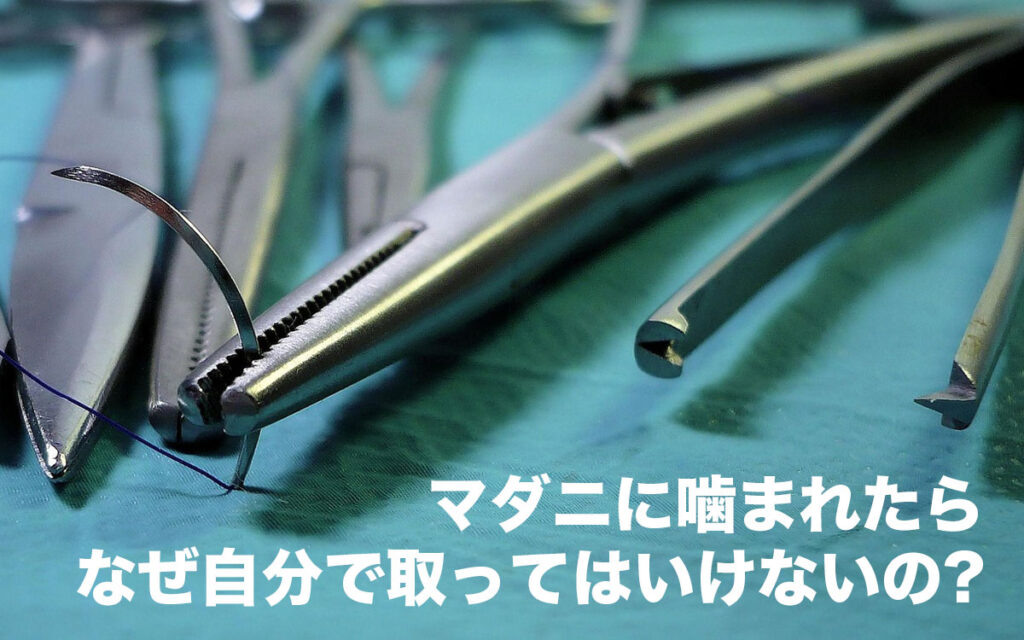 マダニに噛まれたら自分で取ってはいけない理由とは